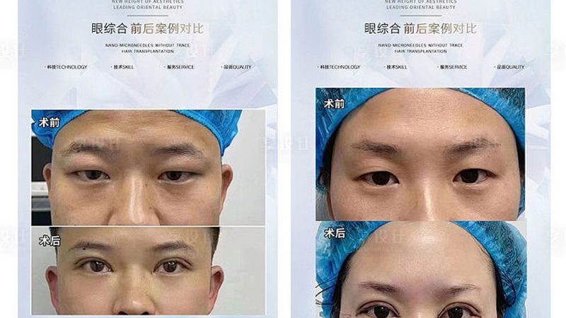 水光针与玻尿酸：揭秘两者差异，揭秘价格之谜