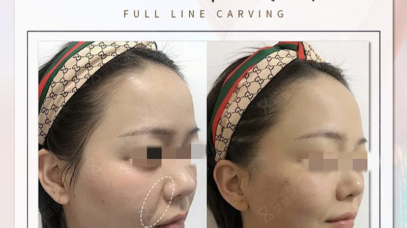 首先，选择抗衰瑜伽加盟代理，首要条件是确保加盟商具备合法的资质。这包括：