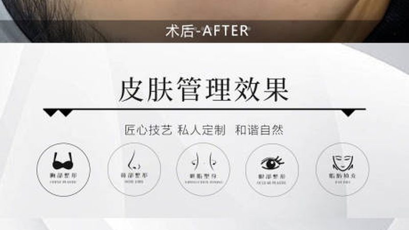 小标题：术前咨询的重要性