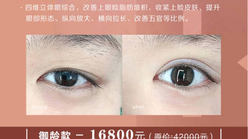 肋软骨隆鼻：揭秘适合人群与禁忌人群