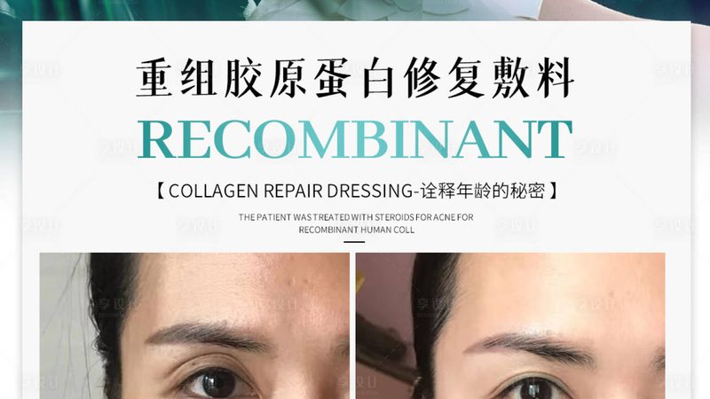 超声炮面部提升：揭秘技术原理与选择标准