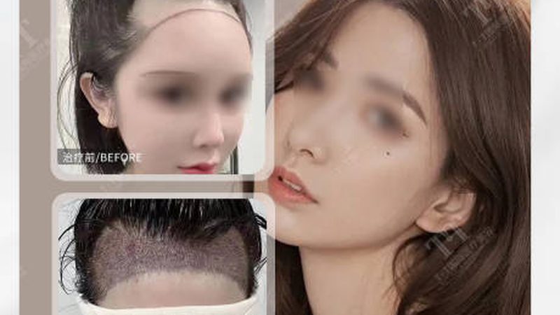 上海整形医院口碑最好的是哪家