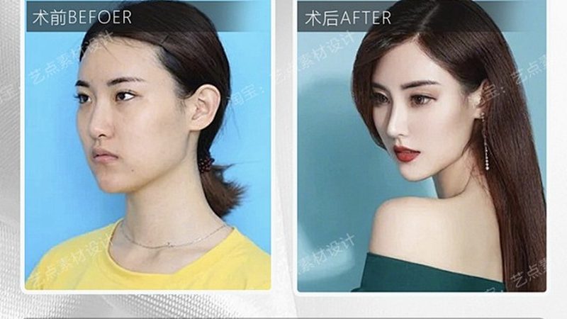 瘦脸瑜伽，轻松塑造精致小脸教程