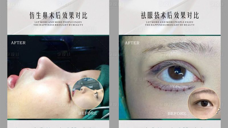 家用激光脱毛仪选购攻略：如何避开陷阱，找到售后好品牌