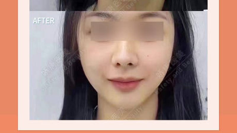 医美机构麻醉科设置标准：安全守护的基石