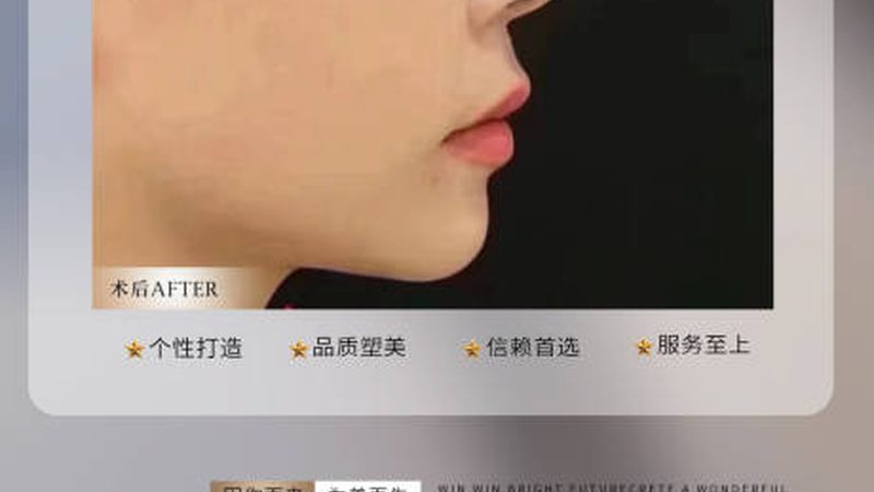 皮肤管理店选址：避开这些“雷区”才能稳扎稳打