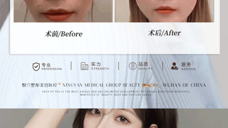 面部年轻化注射方案，如何精准选择？**