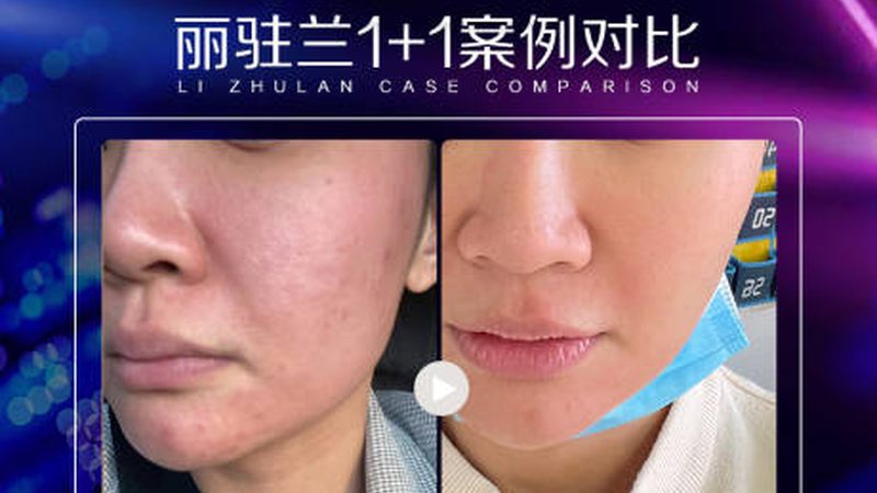轻医美培训学校学费能退吗？揭秘退费那些事儿