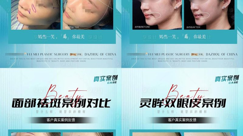 上海埋线提升超声刀，了解价格前先看这些关键点**