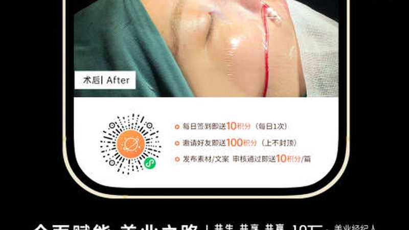 医美耗材批发厂家直供，揭秘背后的行业秘密