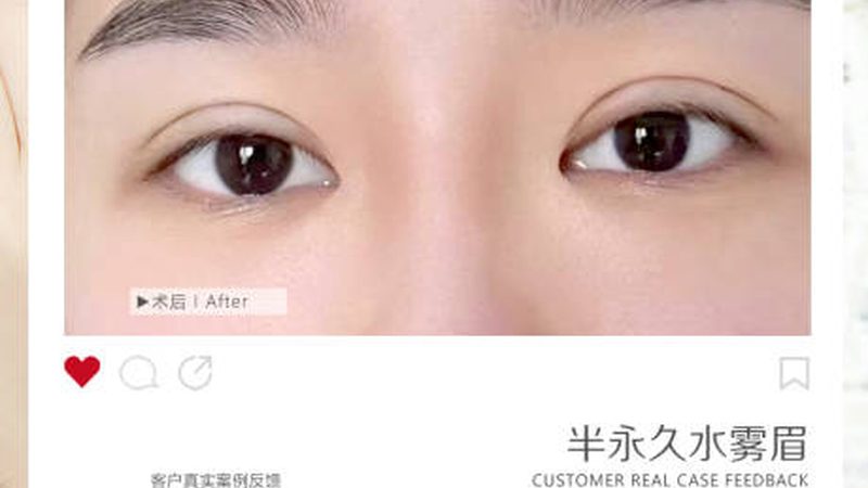 机打水光针与手工水光针注射步骤大揭秘