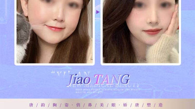 小标题：肉毒素瘦腿原理解析