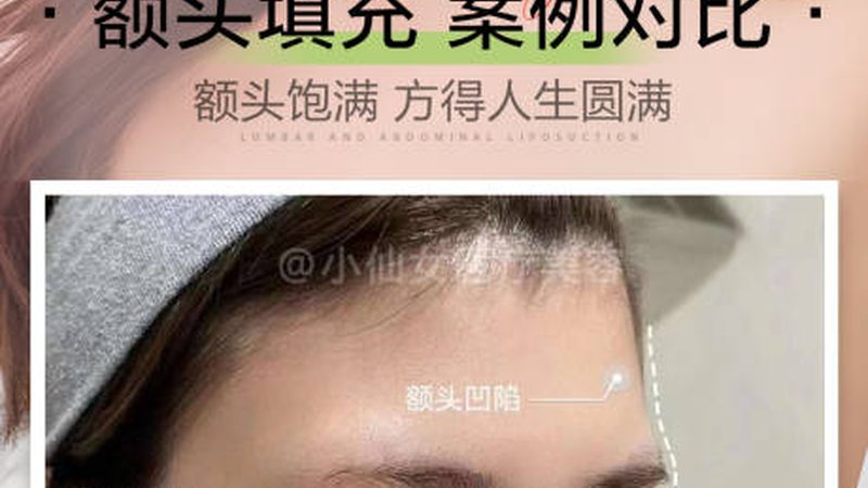 激光祛斑，设备参数揭秘：如何选择适合自己的设备？**